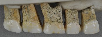 Dentadura superior derecha de Homo luzonensis 