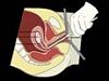 Aborto en argentina